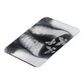 蝶の胃内のX線 マグネット (左側)