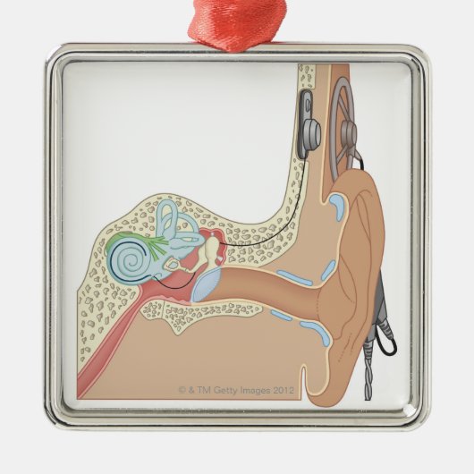 蝸牛なインプラント メタルオーナメント (正面)