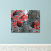 血栓2 キャンバスプリント (インサイチュ (ウッドフロア))