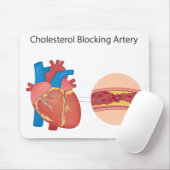 血管の狭窄 マウスパッド (マウス)