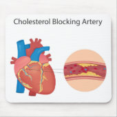 血管の狭窄 マウスパッド (正面)