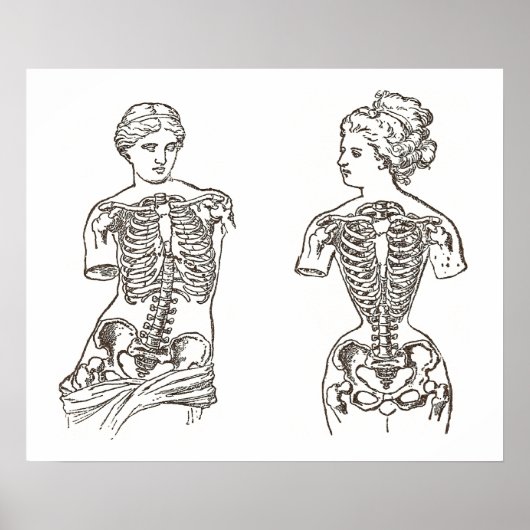 装身用コルセットの身体的影響プリント ポスター (正面)