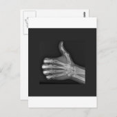 親指 ポストカード (正面/裏面)