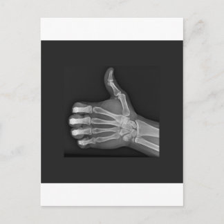 親指 ポストカード