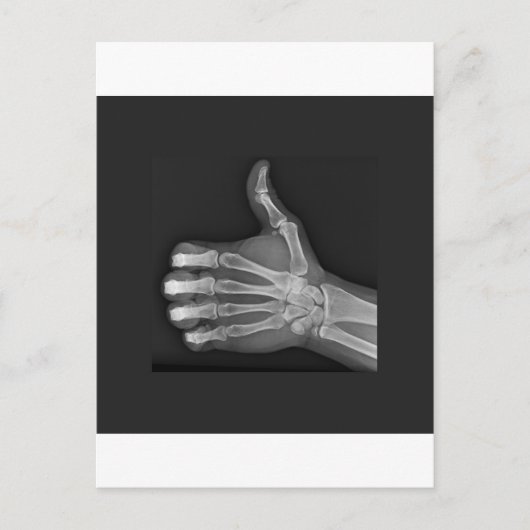 親指 ポストカード (正面)