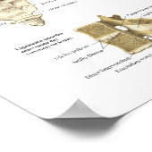 解剖学検査ポスタスペインのー背骨解剖学 ポスター (角)