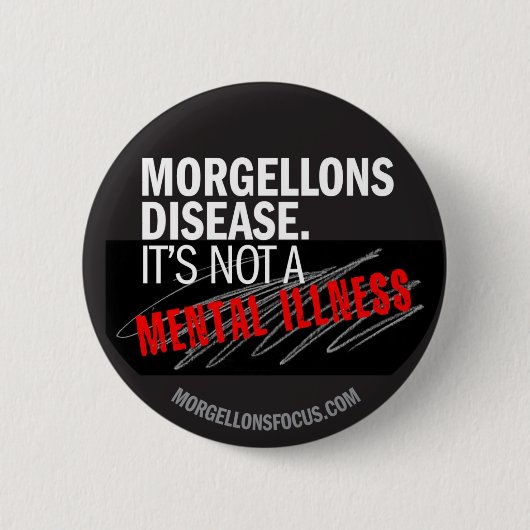 認識度ボタン-黒 缶バッジ (正面)