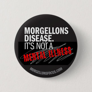 認識度ボタン-黒 缶バッジ