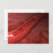 赤血球流動脈断面積 ポストカード (正面/裏面)