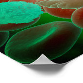 赤血球赤血球貧血 ポスター (角)