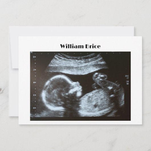 超音波かぼちゃ秋レターボード妊娠 案内状 (裏面)