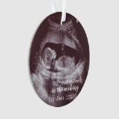 超音波ソノグラム写真を作る我々の奇跡 オーナメント (正面)