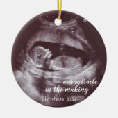 超音波ソノグラム写真を作る我々の奇跡 セラミックオーナメント (正面)