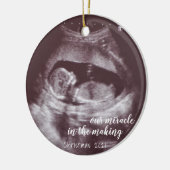 超音波ソノグラム写真を作る我々の奇跡 セラミックオーナメント (左)