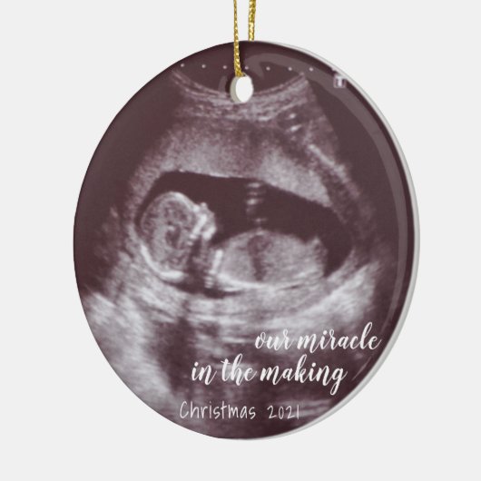 超音波ソノグラム写真を作る我々の奇跡 セラミックオーナメント (左)