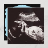 超音波パーソナライズされた写真ベビーシャワー 招待状 (正面/裏面)