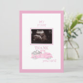 超音波フォトトラック感謝していピンクベビーの視点 サンキューカード (スタンド正面)