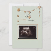 超音波写真ありがとうござおもしろいう サンキューカード (正面)