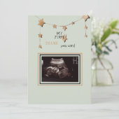 超音波写真ありがとうござおもしろいう サンキューカード (スタンド正面)