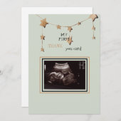 超音波写真ありがとうござおもしろいう サンキューカード (正面/裏面)