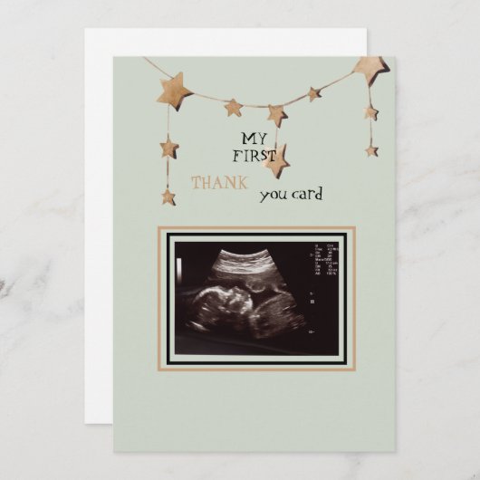 超音波写真ありがとうござおもしろいう サンキューカード (正面/裏面)