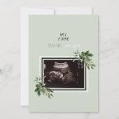 超音波写真ありがとうベビーPoint of View II サンキューカード (正面)