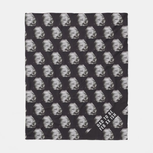 超音波写真のパパファースト・ファースト・ファースト・ファースト・ファースト・ファースト・ファースト・ フリースブランケット (正面)