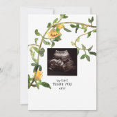 超音波写真ひまわり サンキューカード (正面)