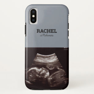 超音波写真ほこりっぽいブルーモノグラム iPhone X ケース