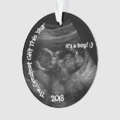 超音波写真テンプレートカスタム オーナメント (正面)