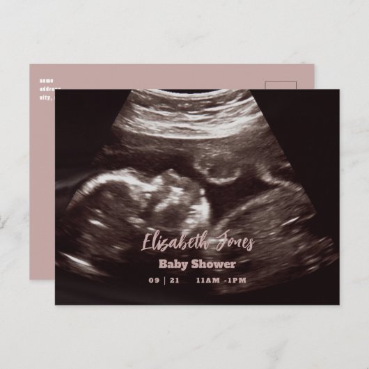 超音波写真ピンクの赤ちゃんシャワー 案内ポストカード (正面/裏面)