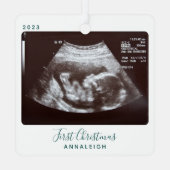 超音波写真初めてのクリスマスソノグラムホリデイ メタルオーナメント (裏面)