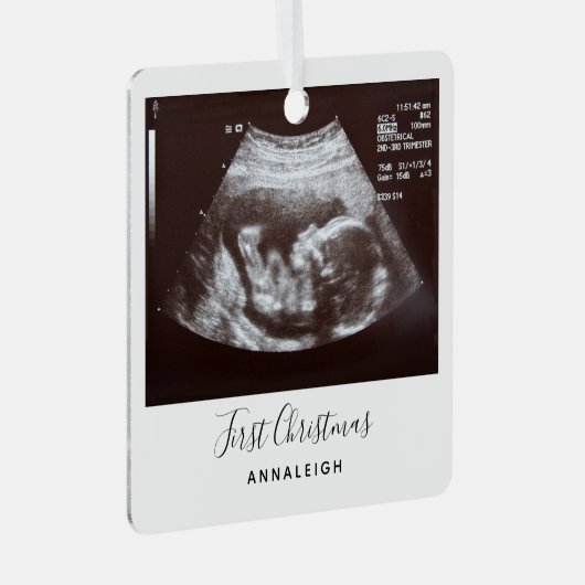 超音波写真初めてのクリスマス休日 メタルオーナメント (正面右)