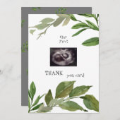 超音波写真感謝してい双生観葉 サンキューカード (正面/裏面)