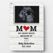 超音波妊娠告知バンプソノグラム フォトプラーク (正面)