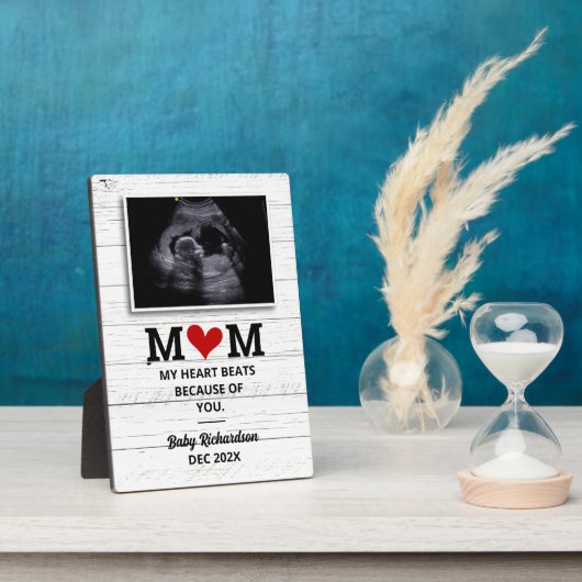 超音波妊娠告知バンプソノグラム フォトプラーク (側面)