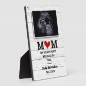 超音波妊娠告知バンプソノグラム フォトプラーク (側面)