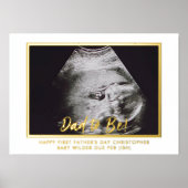 超音波撮影パパ第1父の日 箔ポスター (正面)