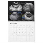 超音波画像カレンダー カレンダー (2月 2026)