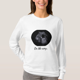 超音波画像入りマタニティTシャツ Tシャツ