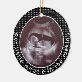 超音波超音波超音波断層撮影の奇跡 セラミックオーナメント (左)