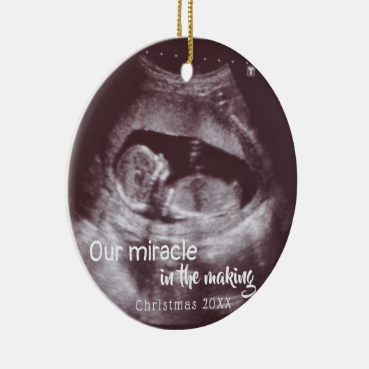 超音波2写真ベビー発表の奇跡 セラミックオーナメント (右)