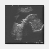 超音波 マグネット (正面)