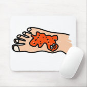 足の病気 マウスパッド (マウス)