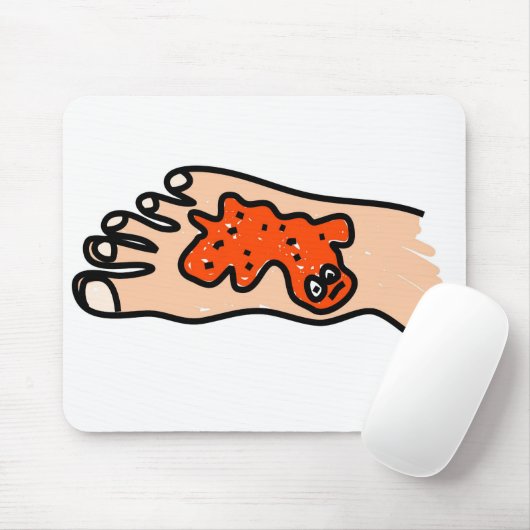 足の病気 マウスパッド (マウス)