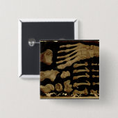 足の骨の解剖スケッチ 缶バッジ (正面&裏面)