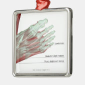 足のMusculoskeleton メタルオーナメント (左)