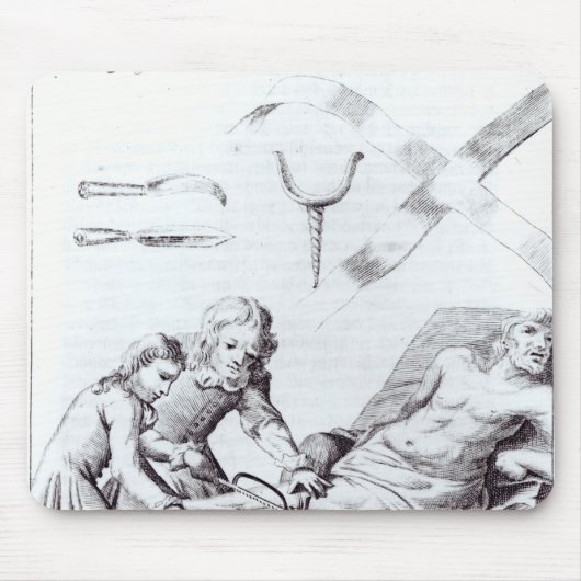 足を切断する外科操作 マウスパッド (正面)