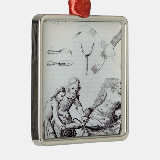 足を切断する外科操作 メタルオーナメント (右)