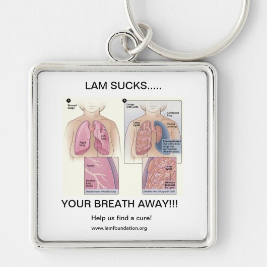 逃亡の最低 キーホルダー (正面)